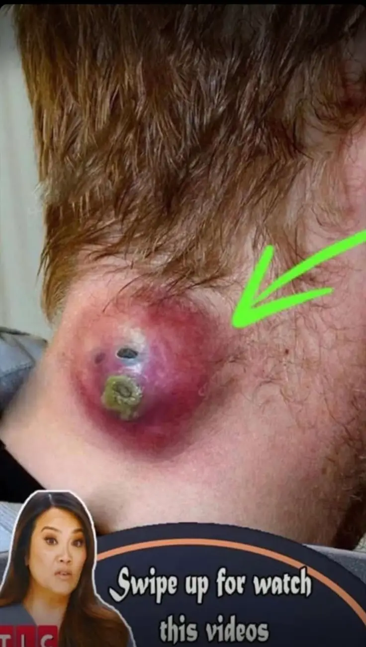 Seven Things That Clog Your Pores And Cause Acne